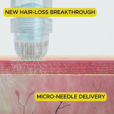 ONEFIX™ Advanced Micro - Infusion Hair Regrowth Set